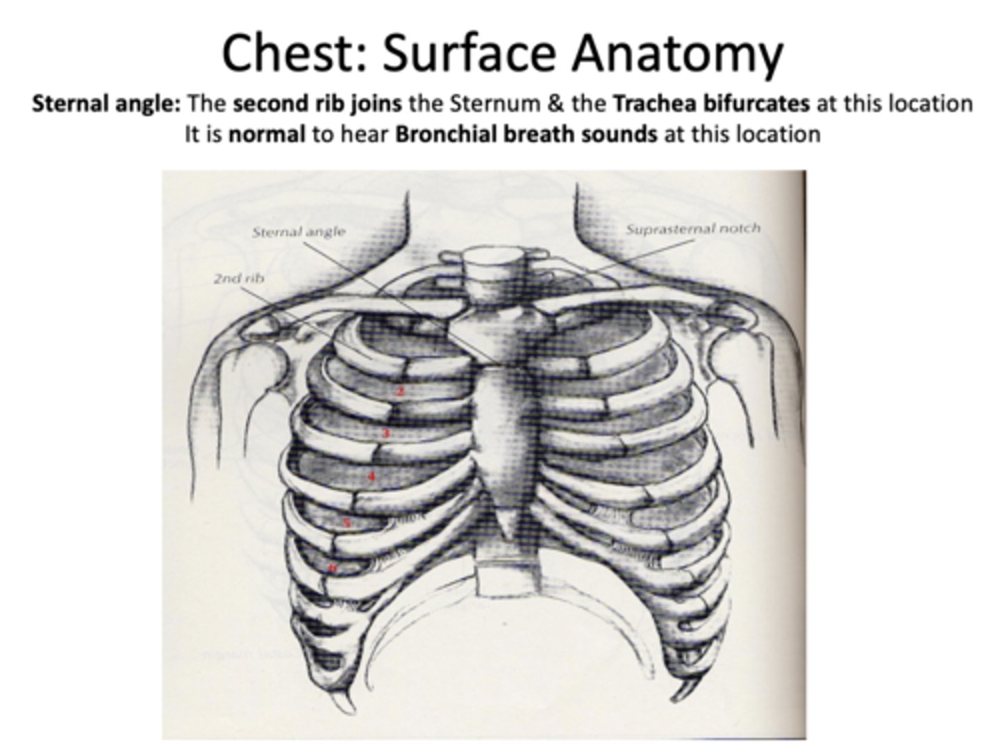 <p>sternal angle</p>