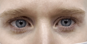 <p>conditions characterized by eyes moving rapidly in a repetitive, uncontrolled movements</p>