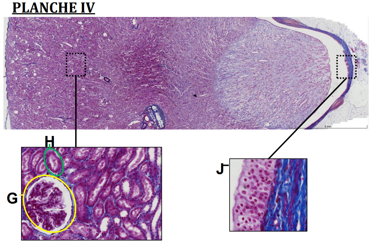 <p>Overgangsepithel</p>