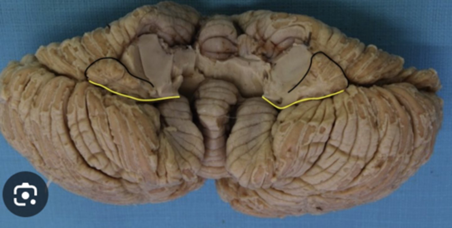 <p>lobe?</p>