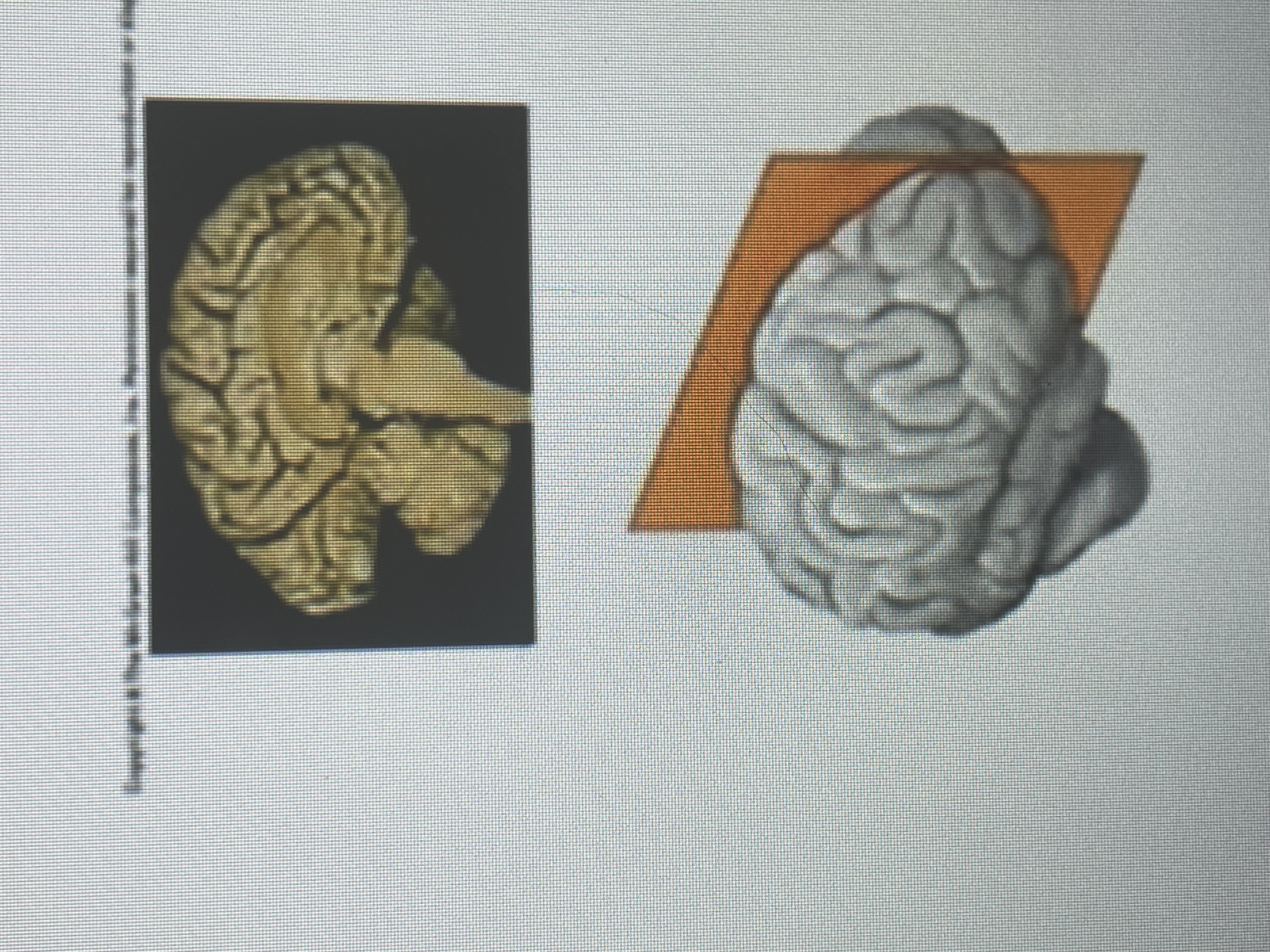 term image