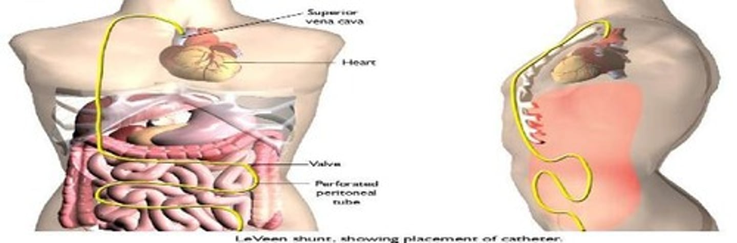 <p>Device to drain fluid from the peritoneal cavity.</p>
