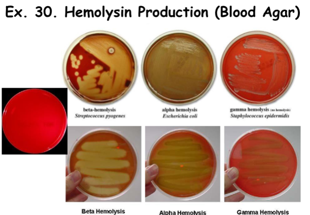 <p><strong>Hemolysin Production: </strong>Beta Hemolysis</p>