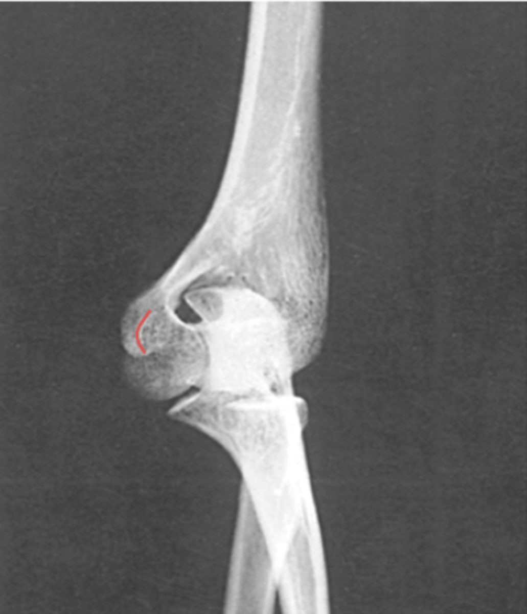 <p>What structure is highlighted?</p>