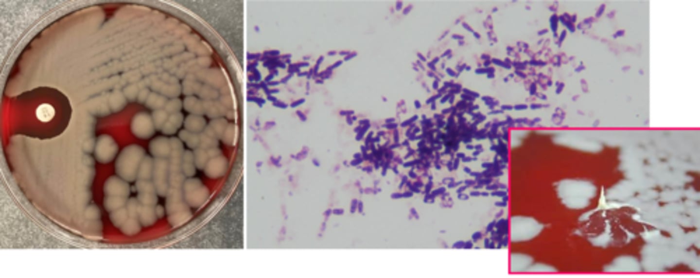 <p>beta hemolytic and motile is ok!</p><p>non beta hemolytic and nonmotile should be watched out for</p><p>spreading colony</p><p>spore-forming bacilli</p>