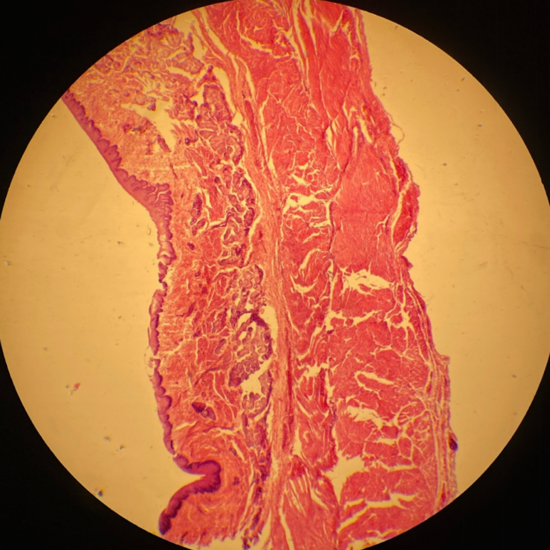 term image