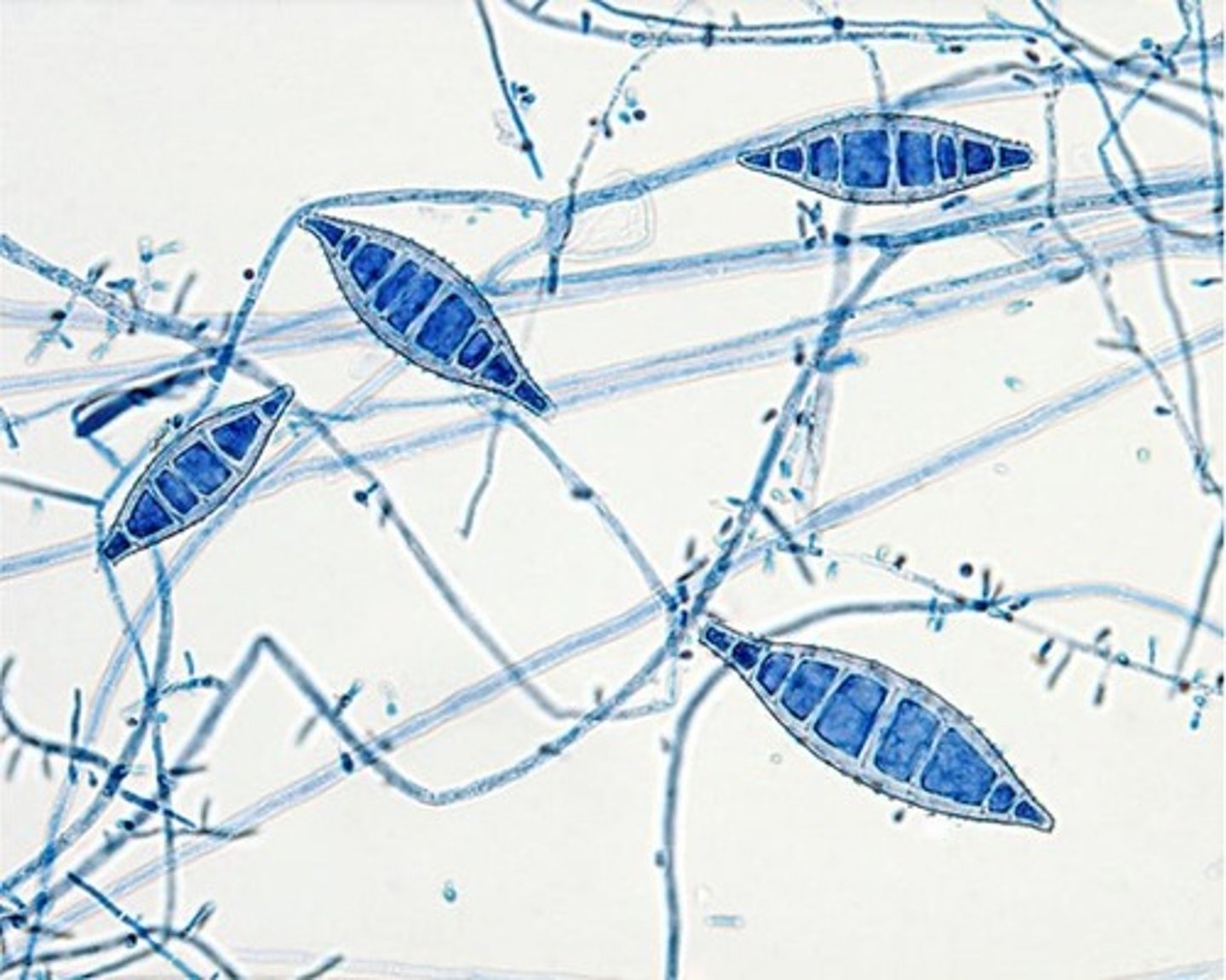 <p>large terminal conidia spore, spore looks like leaf</p>