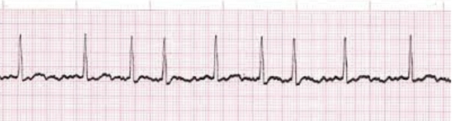 <p>Identify the rhythm! Discuss nursing and collaborative care</p>