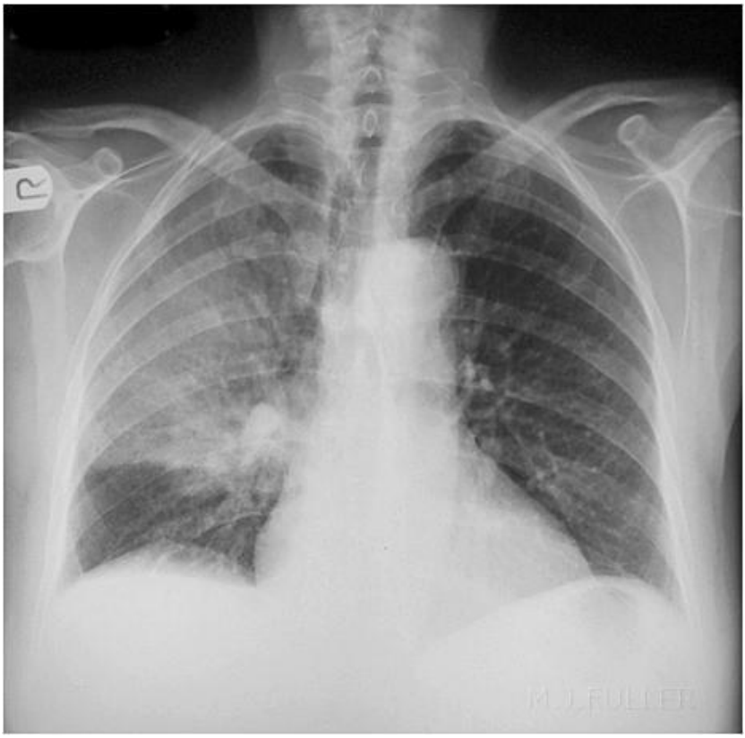 <p>What is this pathology?</p>