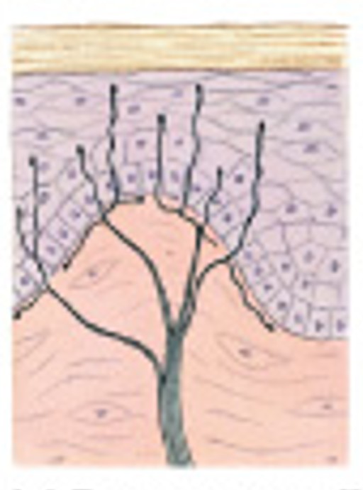 <p>Which type of tactile receptors:</p><ul><li><p>Sensitive to pain &amp; temp. tickle, itch &amp; touch</p></li></ul><p></p>