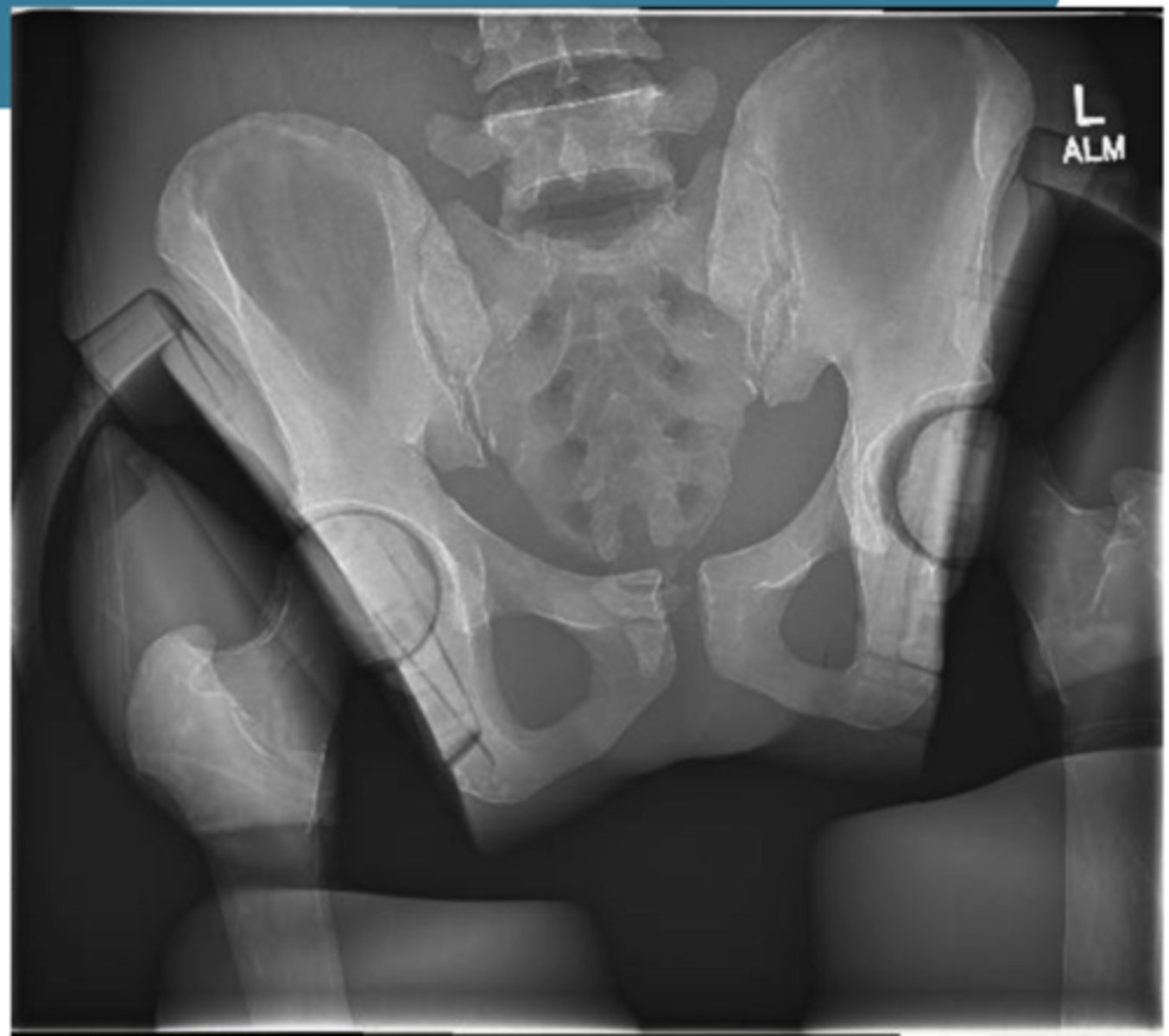 <p>Identify the positioning errors</p>