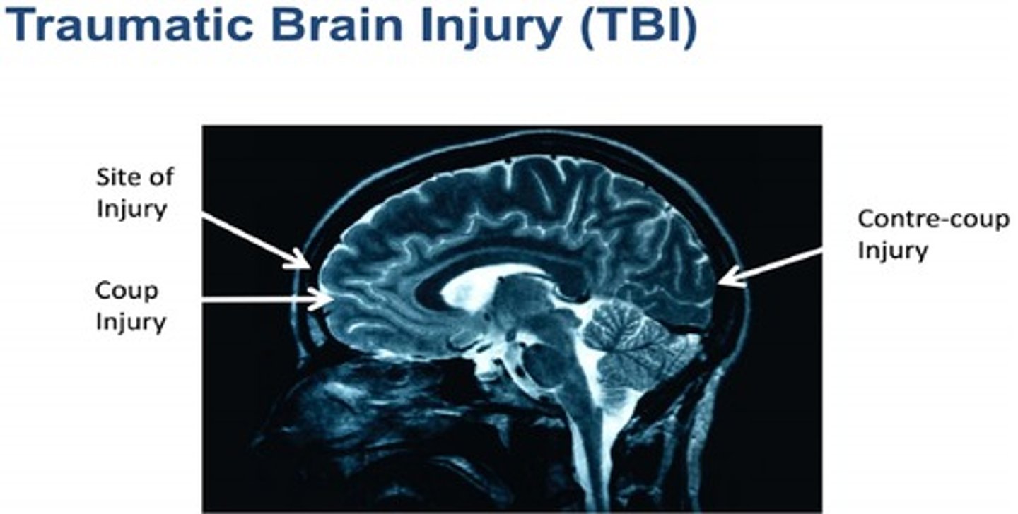<p>"Brain Injury and Disease.</p>
