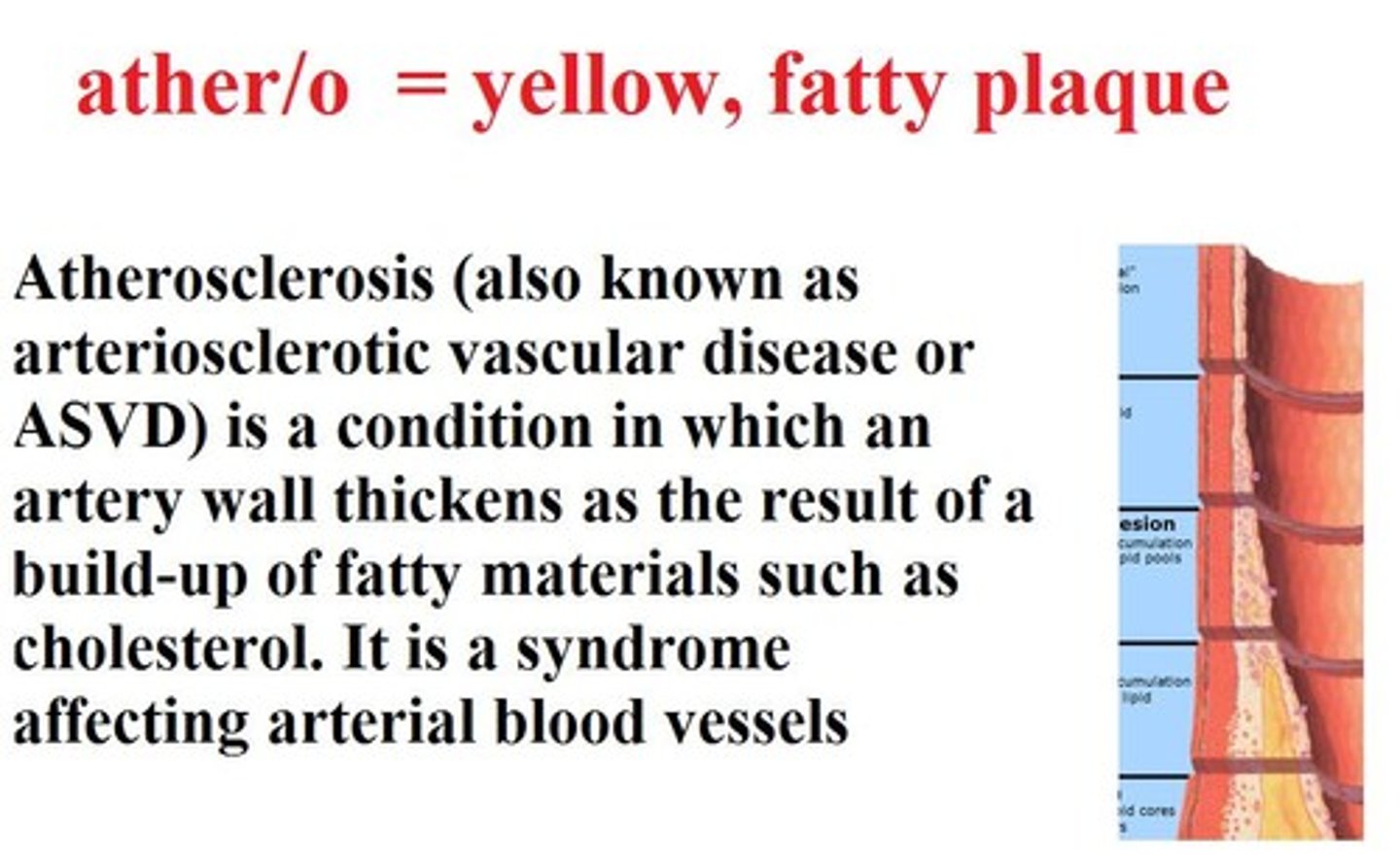 <p>yellow, fatty plaque</p>