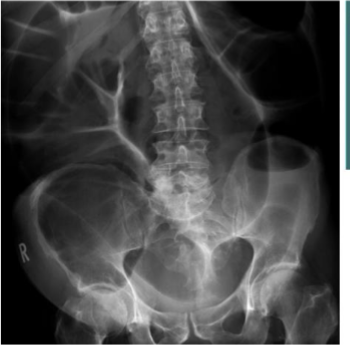 <p>What is this and what type of scan </p>