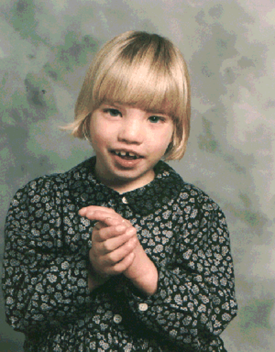 <p>Absence of short arm of 5th chromosome</p><p>high-pitched cry in infants</p><p>low-set ears, narrow oral cavity, laryngeal hypoplasia, microcephaly, hypertelorism, micrognathia, oral clefts.</p><p>Artic and language disorders associated with intellectual disability</p>