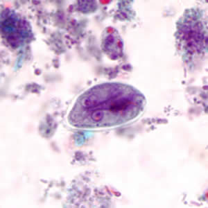 <p>Oval with 2-4 nuclei, retracted cytoplasm, central axoneme</p>