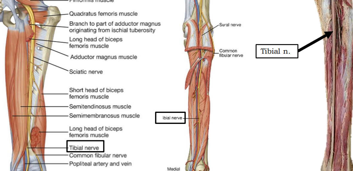 <p>Tibial n. (sacral plexus)</p>