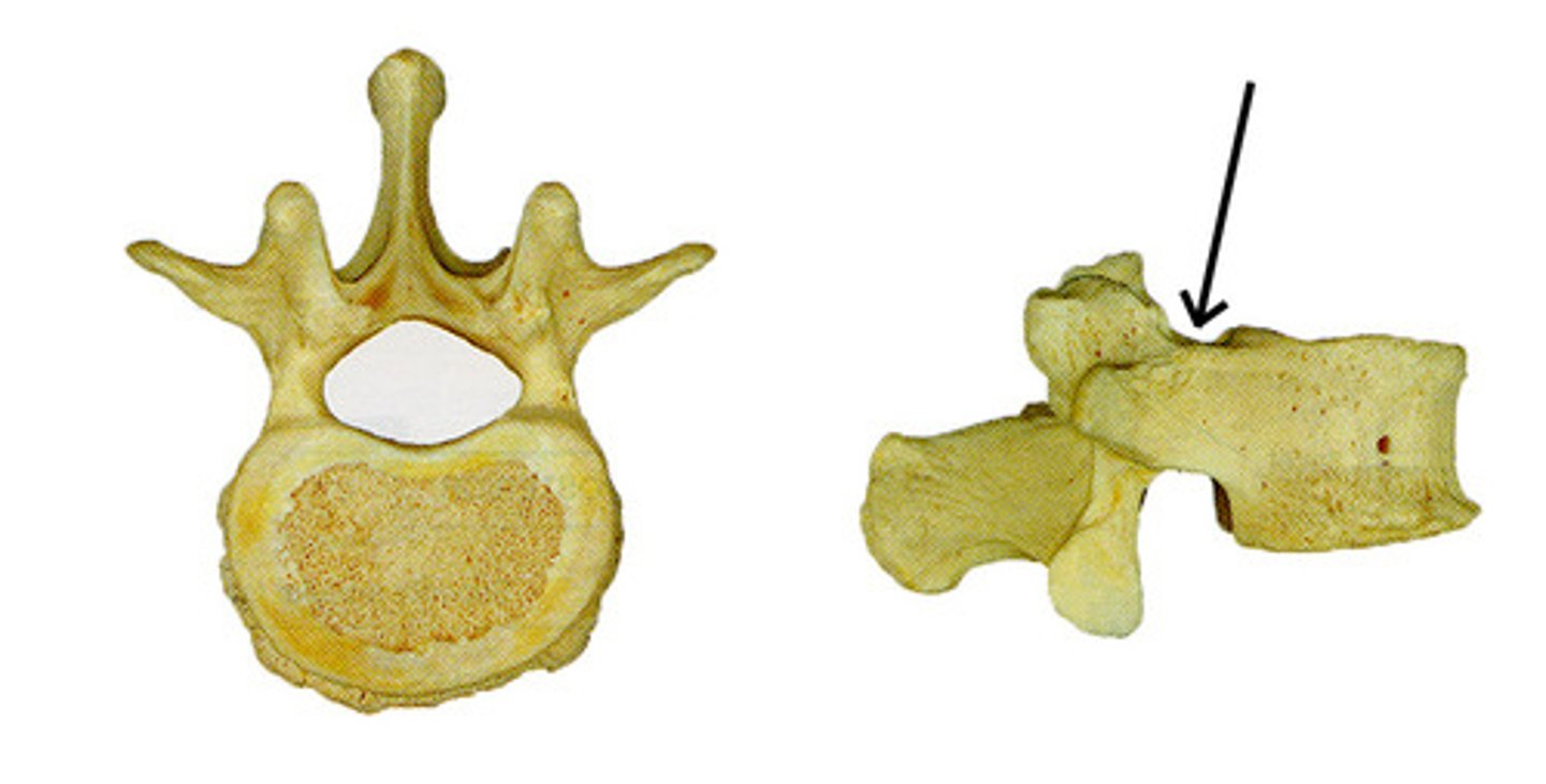 <p>forms lower margin of intervertebral foramen</p>