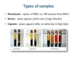 <ul><li><p>haemolysis</p></li><li><p>icterus</p></li><li><p>lipaemia</p></li></ul><p></p>