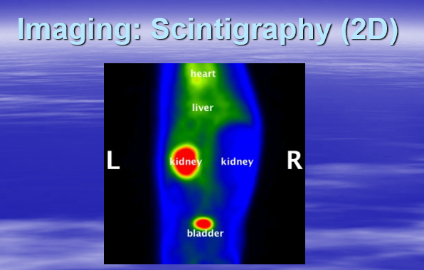 <p>Another image of Scintigraphy (2D)&nbsp;</p>