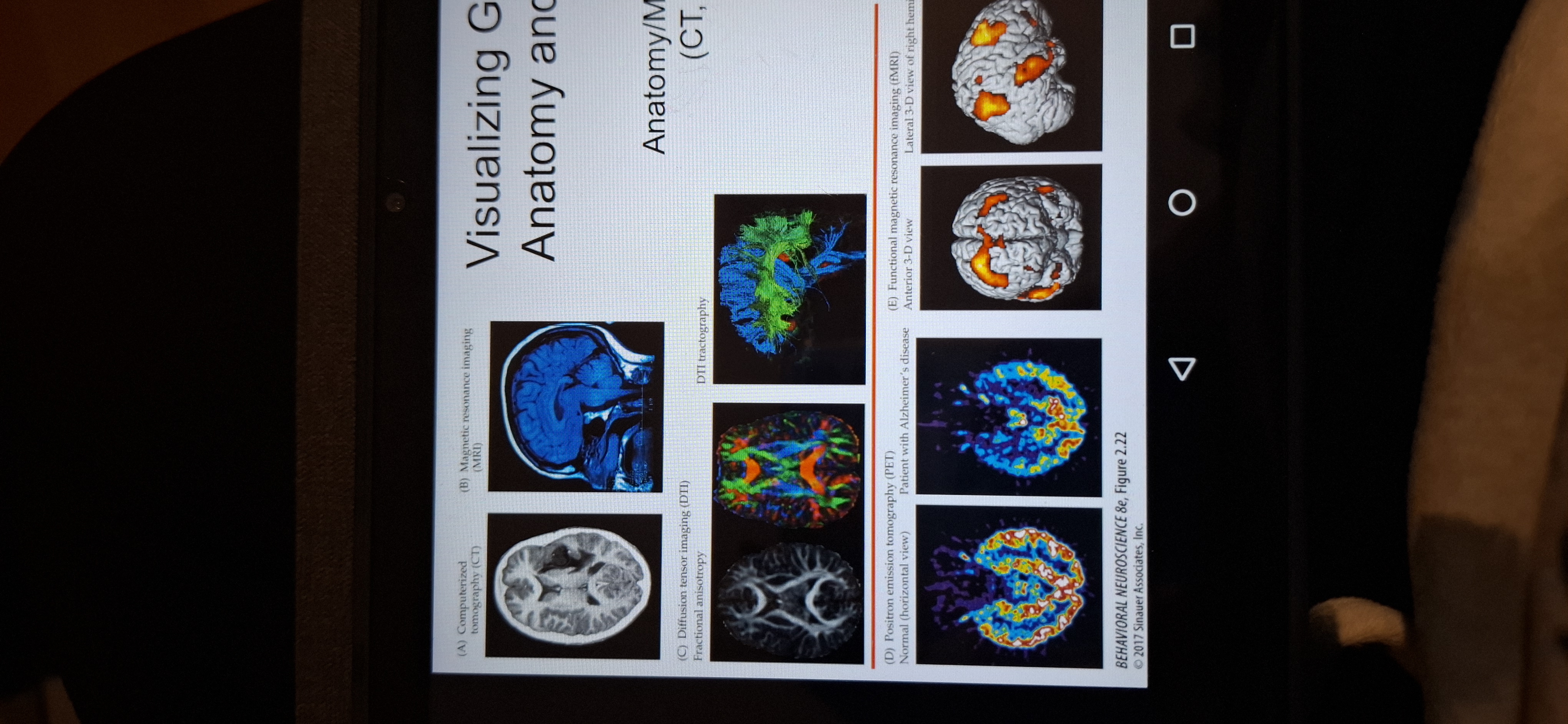 <p>Usr ct scans,mri,dti,physiology( PET,fMRI)</p>