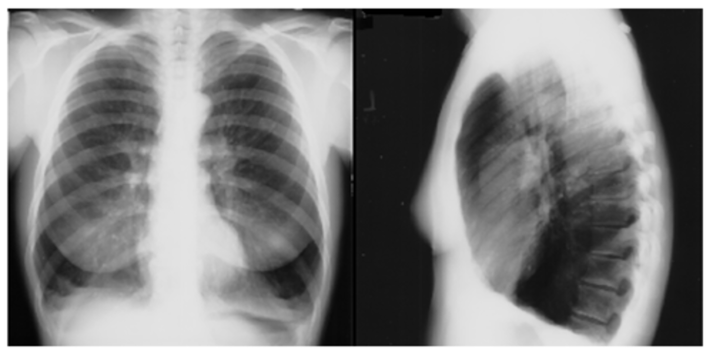 <p>Dx and ID radiological findings</p>