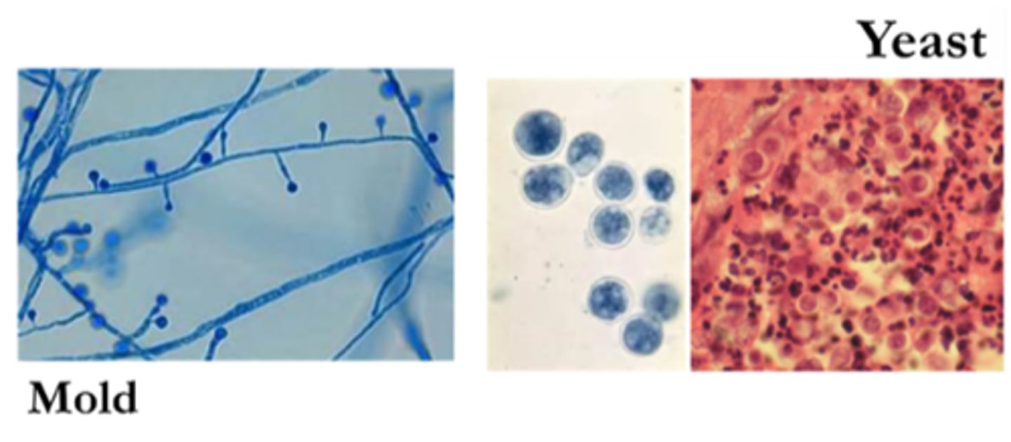 <p>· Soil (alkalinity, moisture, organic matter); inhalation</p><p>· Lollipop (single) conidia, at top of conidiophores</p><p>· Big, broad -based buds of Blasto</p>