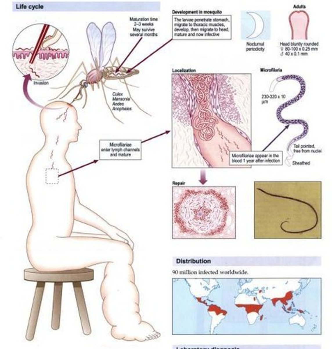 <p>Copepods may be removed from suspected water using a finely meshed filter.</p>