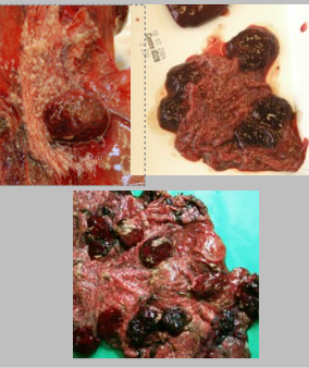 <p>What is the likely causative agent of this abortion? Describe the pathology and pathophysiology.</p>