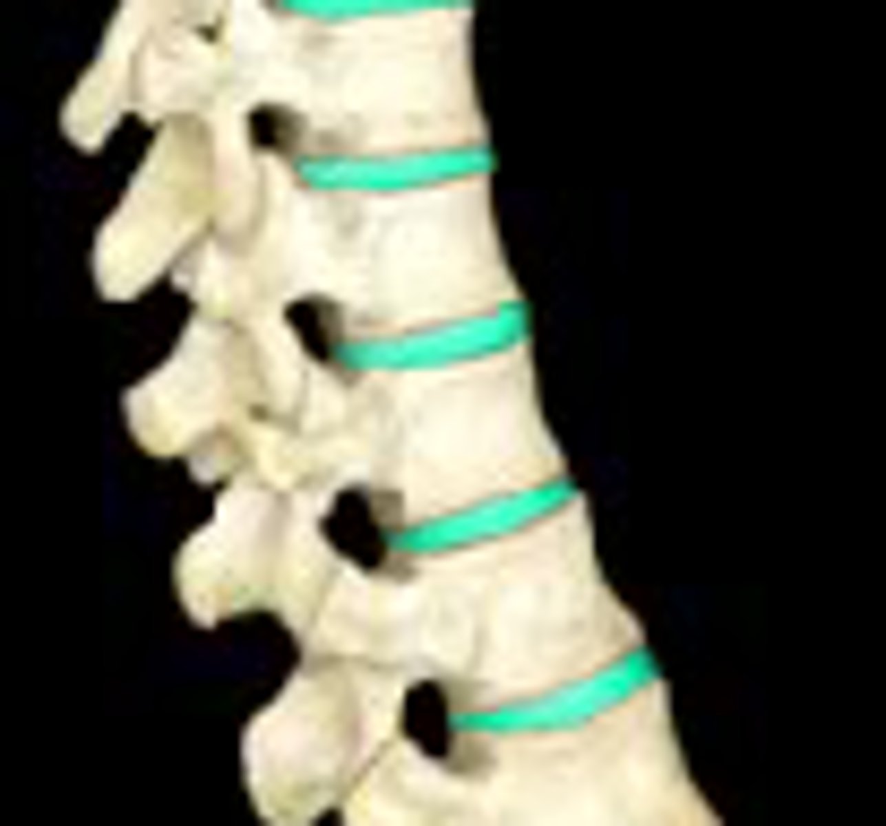 <p>Fibrocartilage pads between vertebrae.</p>