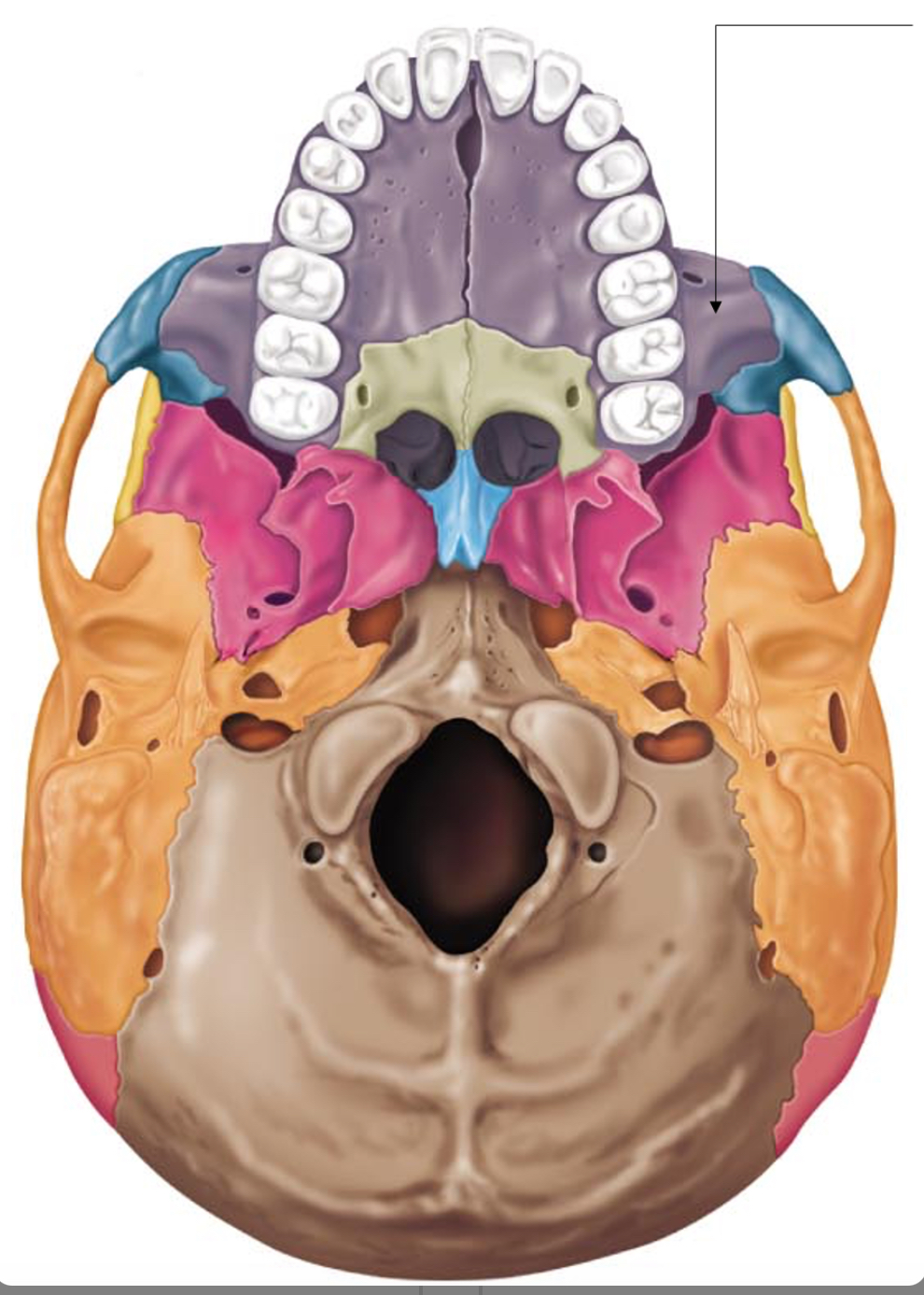 term image