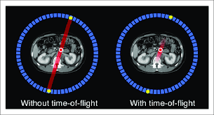 <p><span>How does <strong>time flight technology</strong> affect how our images on <strong>PET</strong> turn out?</span></p>