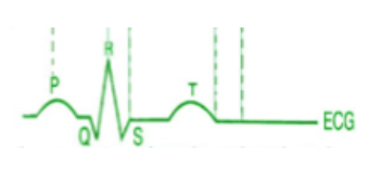 <p>what does the P wave indicate on an EKG?</p>