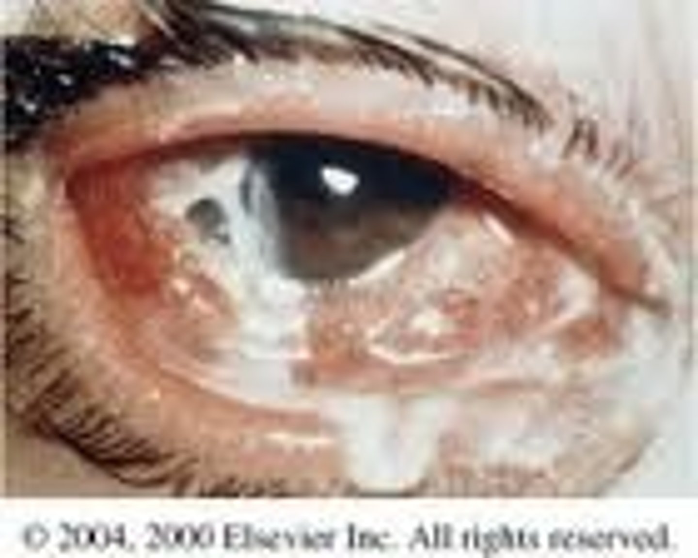 <p>caused by or connected with bacteria</p>