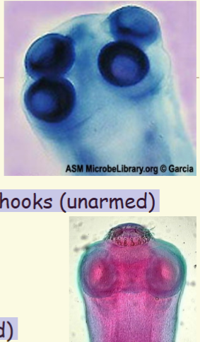 <p><span>T. saginata</span><br><span>– rounded, 1-2 mm in size</span><br><span>– 4 sucking disks</span><br><span>– no rostellum or attachment hooks (unarmed)</span><br><br><span>T. solium</span><br><span>– 4 sucking disks</span><br><span>– Rostellum with hooks (armed)</span><br><span>– double row of 25-30 chitinous hooks (armed)</span><br><span>– hooks arranged around the rostellum</span></p><p><br></p>