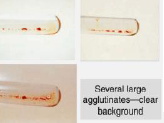 <p>Agglutination Grading</p>