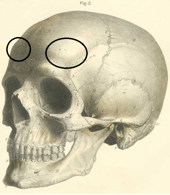 <p>Which frontal bone marking is this? (2)</p>