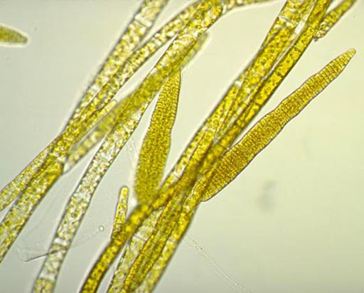 <p>yellow shit </p>