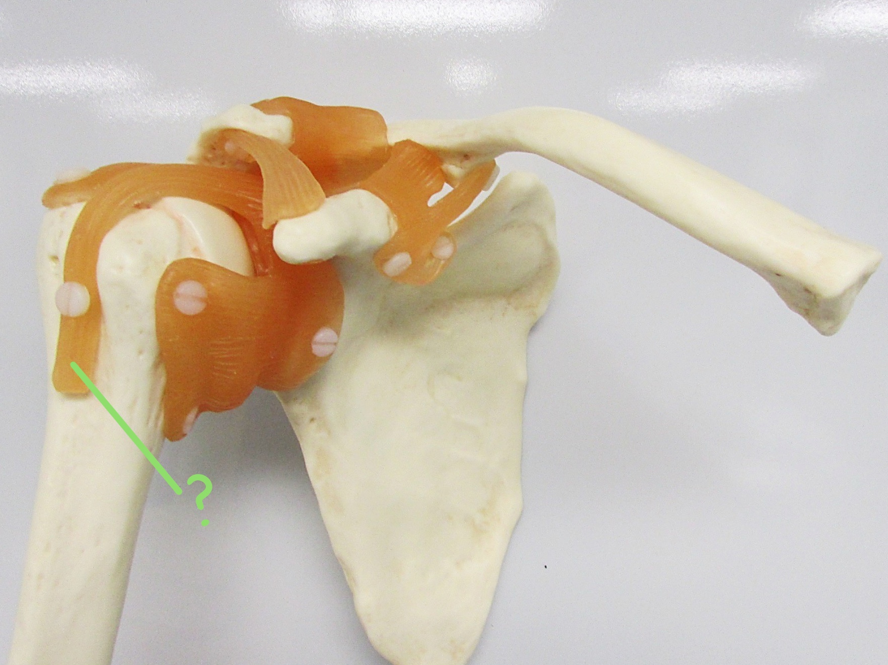 <p>Determine the part of the shoulder joint highlighted</p>