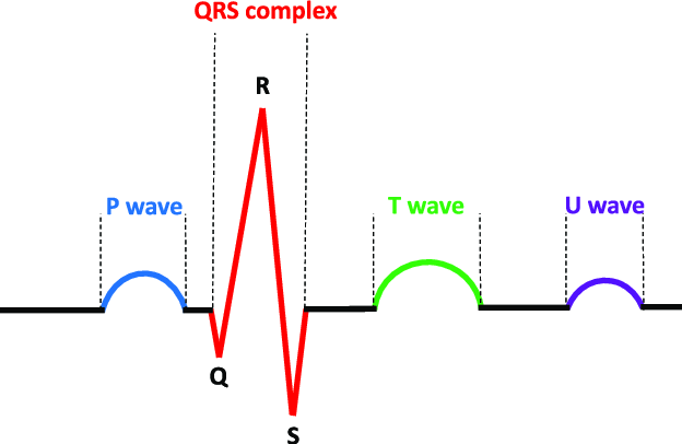 Ventricular depolarization

Occurs just prior to ventricular contraction