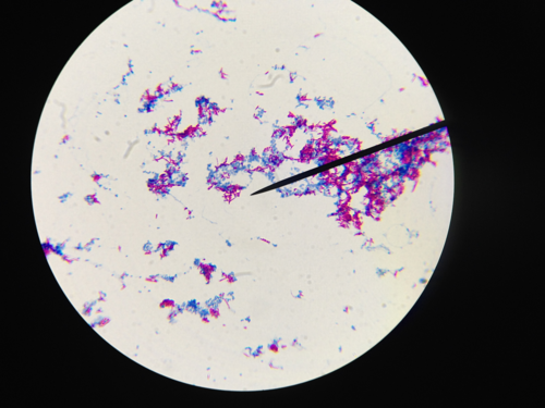 Identify the genus of bacteria that stain red (acid fast) in the acid fast stain