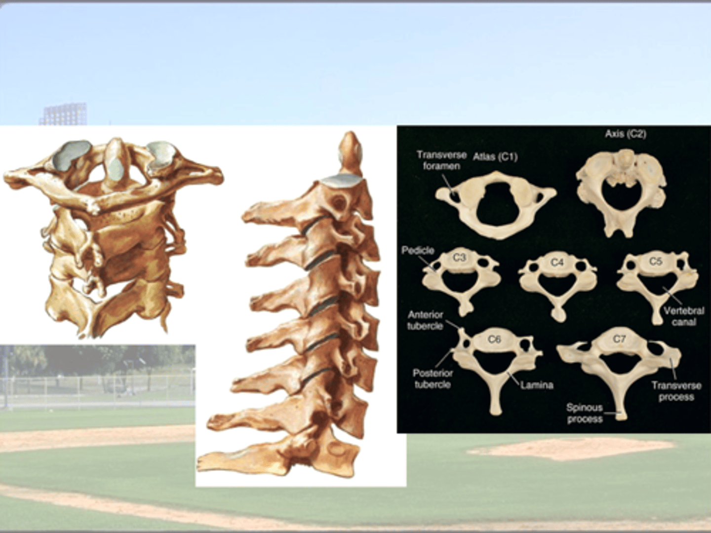 <p>Suboccipital (upper C-spine) </p><p>= occipital bone, C1, &amp; C2 </p><p>(2 spinal segments)</p><p>Lower Cervical Spine</p><p>bottom of C2 - Top of T1 </p><p>(6 spinal segments)</p>