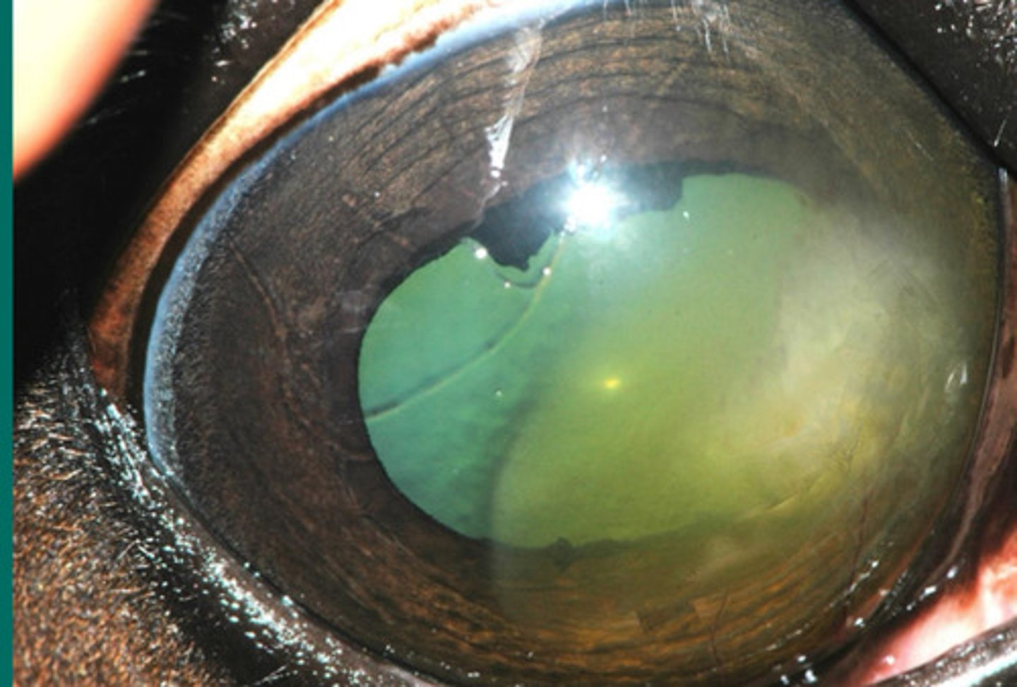 <p>What is happening in this eye, where plasma staining is evident?</p><p>a. immune mediated epithelial keratitis</p><p>b. chronic SUPERFICAL stromal immune mediated keratitis</p><p>c. chronic RECURRENT DEEP stromal immune mediated keratitis</p><p>d. eosinophilic keratitis</p><p>e. immune mediated endothelitis</p>