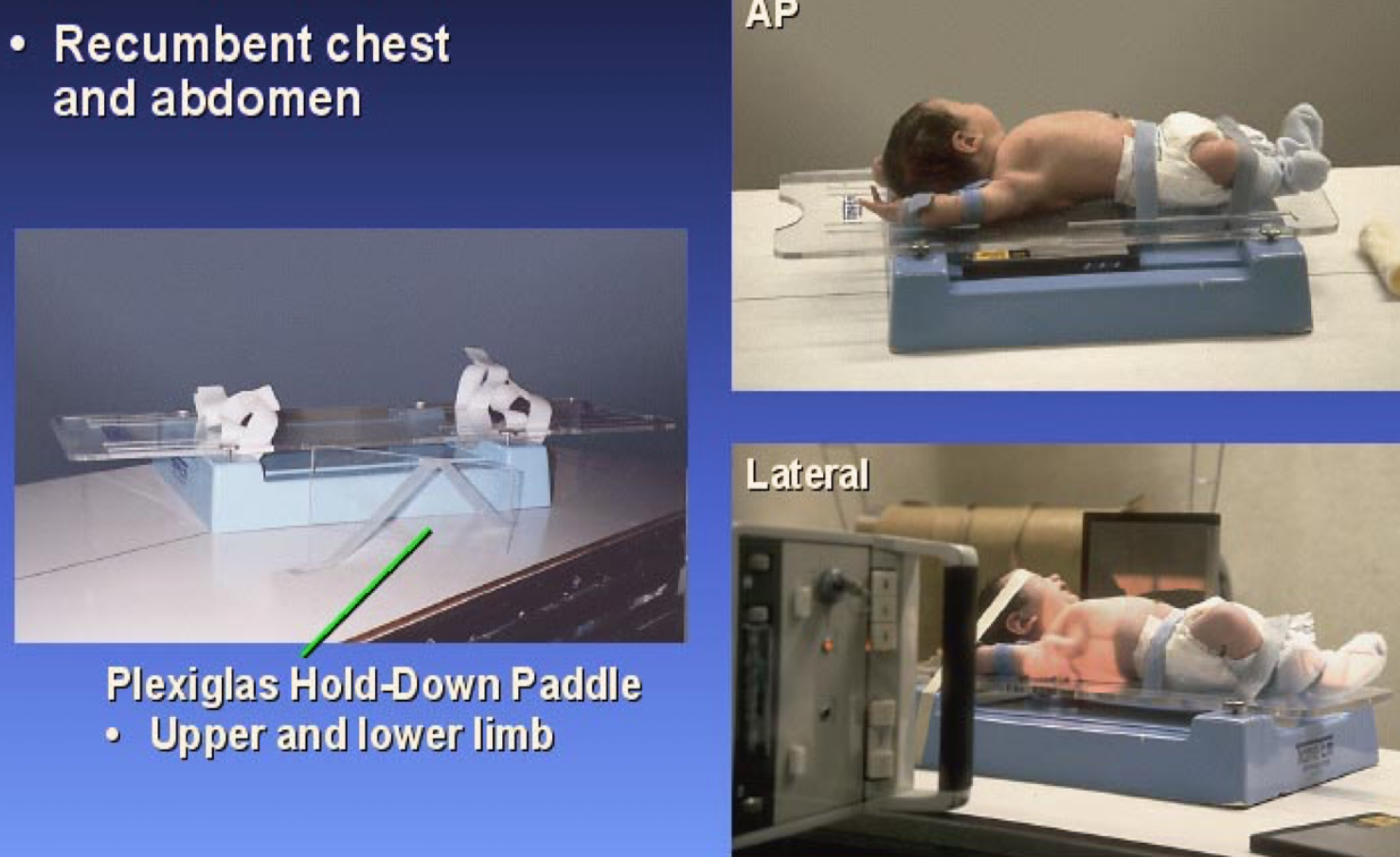 <p>What type of immobilization device is this?</p>