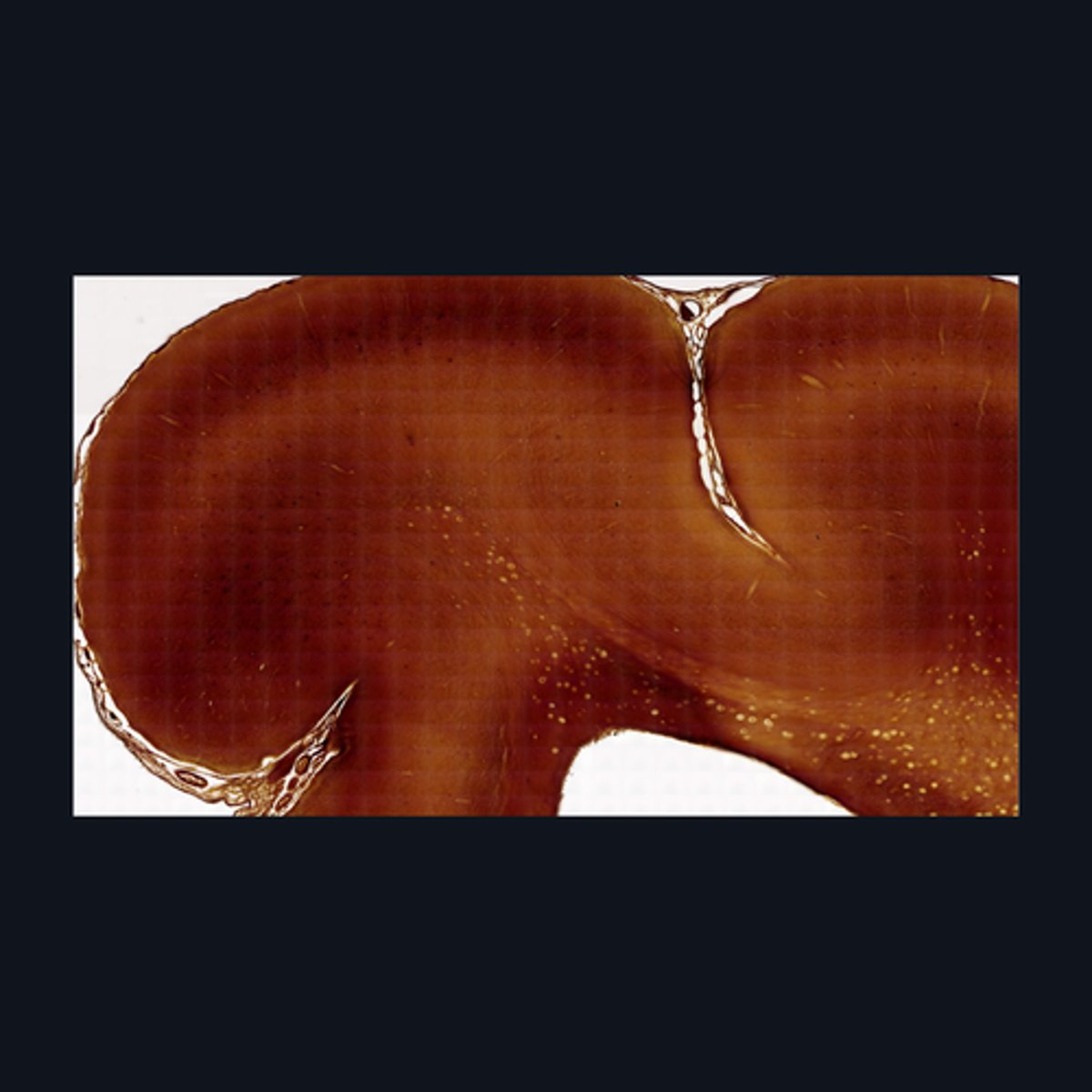<p>Identify this structure.</p>