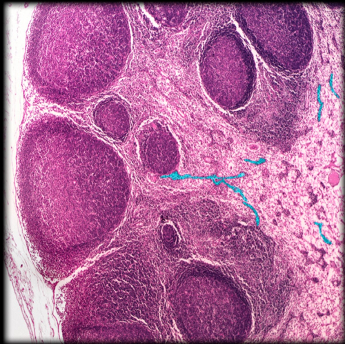 <p>Lymph node</p>