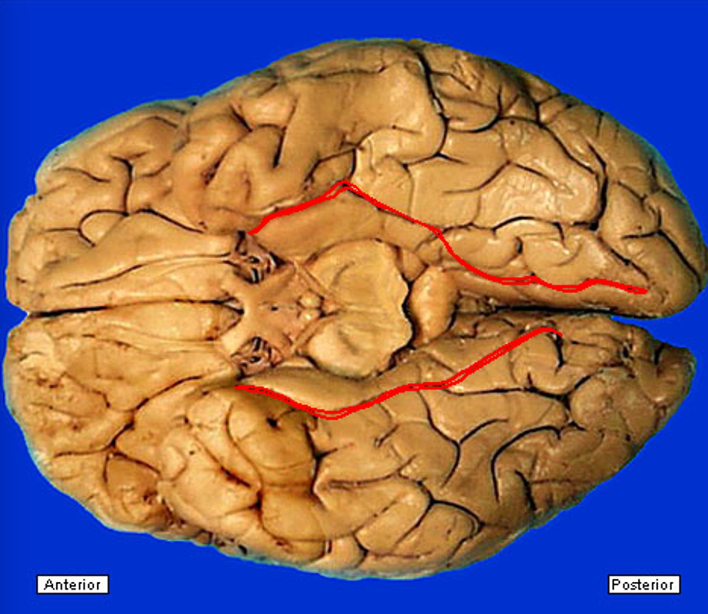 <p>behind parahippocampal gyrus</p>