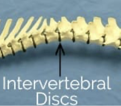 <p>Each spinal segment has<strong> two roots</strong> on EACH side…</p><ul><li><p><strong>Dorsal root</strong> → divides into rootlets</p></li><li><p><strong>Ventral root → </strong>divides into rootlets</p></li></ul><p></p><p>The dorsal and ventral roots meet on the OUTSIDE of the vertebrae to form a spinal nerve</p><ul><li><p>Pass through the<strong> intervertebral foramen</strong> between each vertebrae (see image)</p></li><li><p>This can also be an area where nerves can get PINCHED</p></li></ul><p></p>