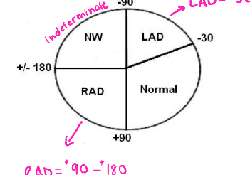 <p>If the average vector is between ___ and ___, then there is left axis deviation</p>