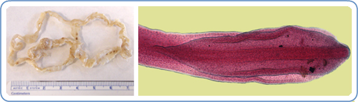 <ul><li><p>“Double leaf” or “Broad fish tapeworm”</p></li><li><p>Affects: Dogs, cats, humans​</p></li><li><p>Adults in small intestine​</p></li><li><p>Intermediate host: crustacean, then fish​</p></li><li><p>Found in: Scandinavia, Ukraine, N. America​</p></li><li><p>2m to 12m long​</p></li><li><p>Four acetabula and two bothria​</p></li><li><p>Can cause pernicious anemia in host due to B12 absorption, gravids detach in small chains​</p></li><li><p>Largest human tapeworm</p></li></ul><p></p>